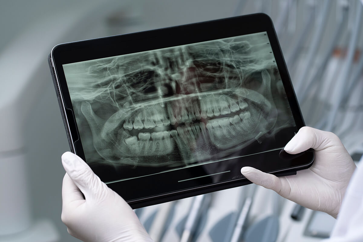 endodoncja mikroskopowa wrocław